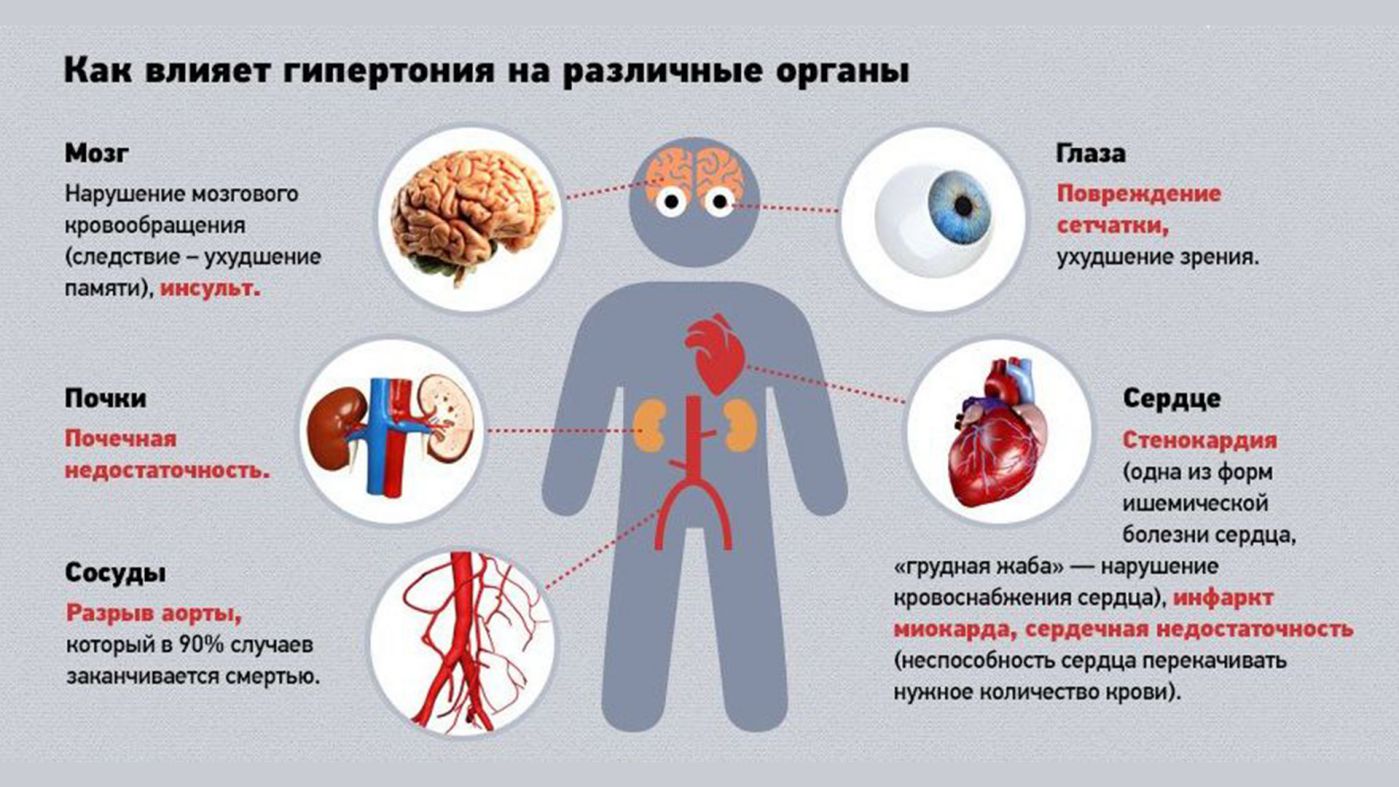 Осложнения гипертонической болезни