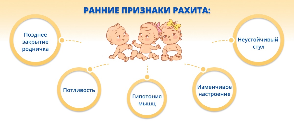 Признаки рахита