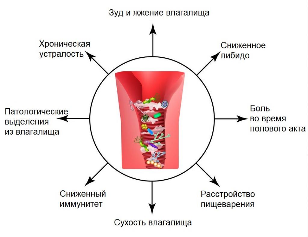 Симптомы кольпита